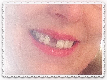 Toothlesss